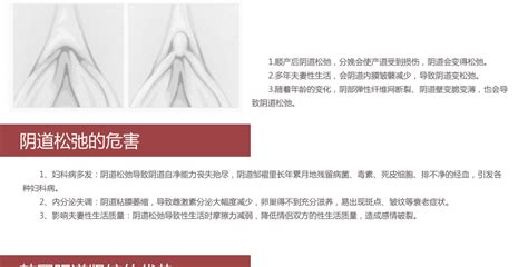 韓式無(wú)痕陰道緊縮術(shù)注意事項(xiàng)