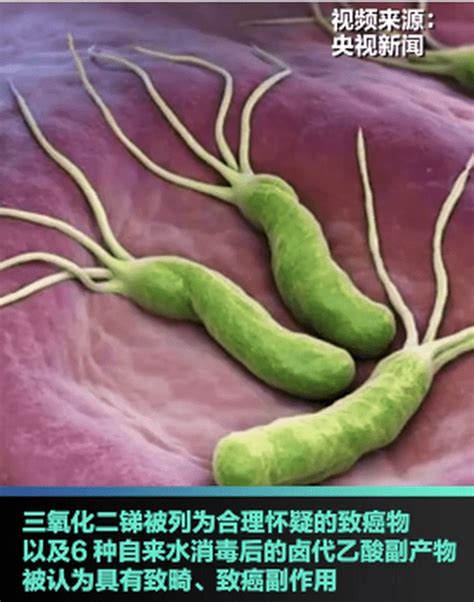 美國將幽門螺旋桿菌列為明確致癌物