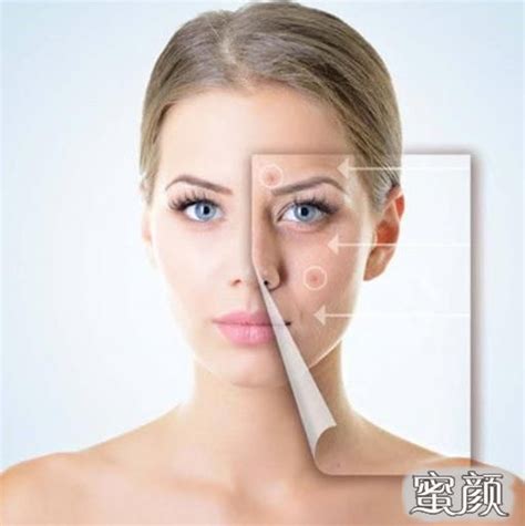 皮膚激光美容是什么(皮膚激光美容方法有哪些)