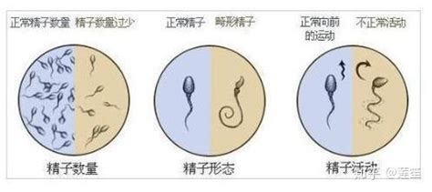 男性怎樣提高精子質(zhì)量