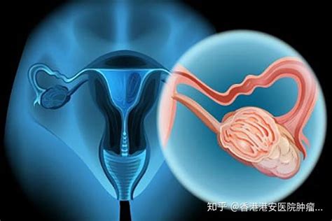 真人早期宮頸癌的分泌物圖片癥狀,警惕惡臭的白帶夾雜血絲