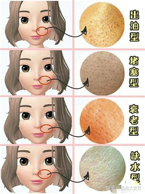 臉上汗毛孔粗大怎么辦 簡單妙招幫你改善汗毛孔粗大